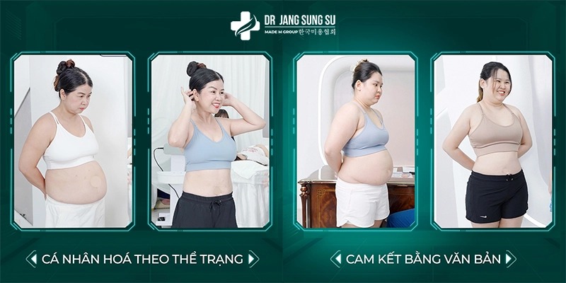 Review giảm mỡ không xâm lấn của khách hàng khi đến Jang Sung Su Review giảm mỡ không xâm lấn của khách hàng khi đến Jang Sung Su