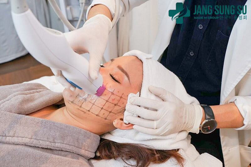 Phương pháp Thermage không xâm lấn đồng thời không cần nghỉ dưỡng Phương pháp Thermage không xâm lấn đồng thời không cần nghỉ dưỡng