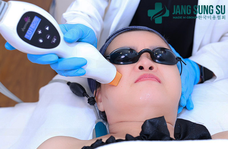 Ai nên làm phương pháp Thermage ? Ai nên làm phương pháp Thermage ?