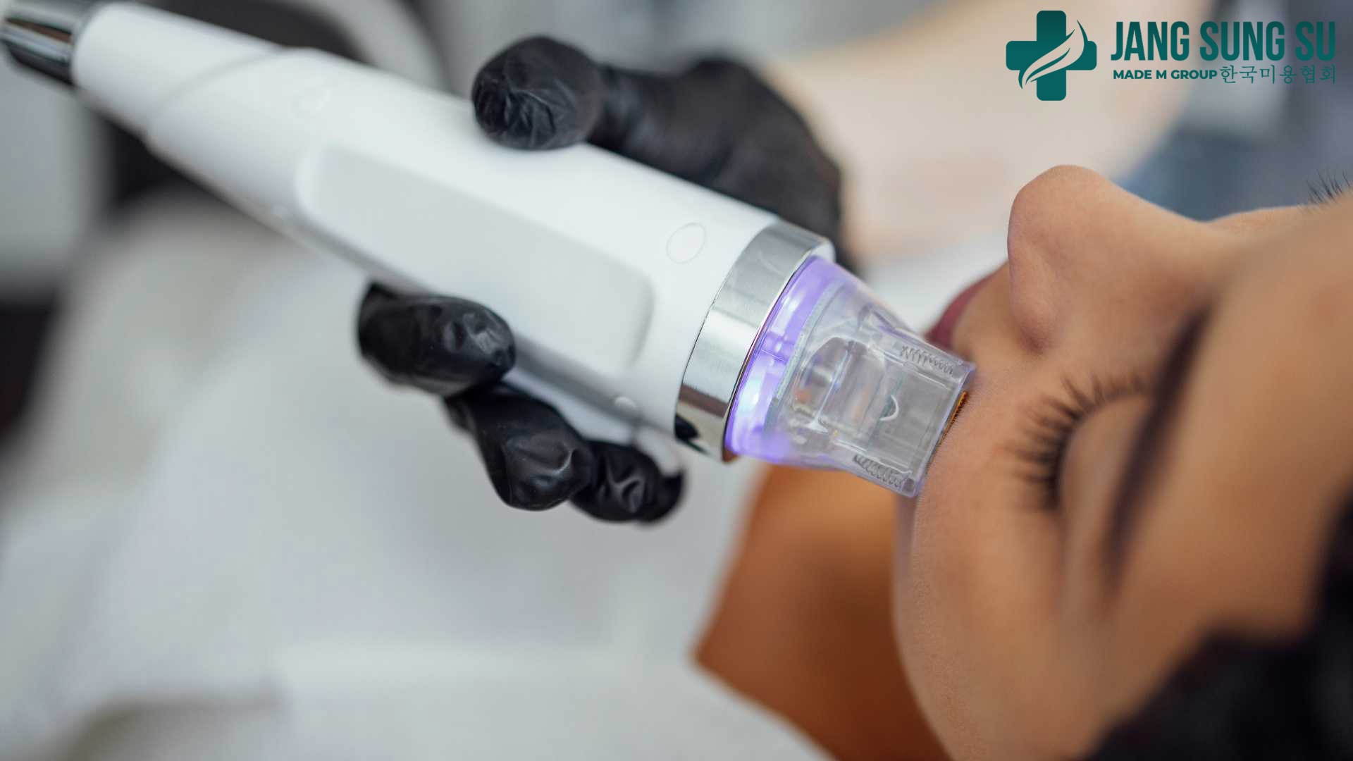 Ưu điểm nổi bật của công nghệ sóng RF Ưu điểm nổi bật của công nghệ sóng RF