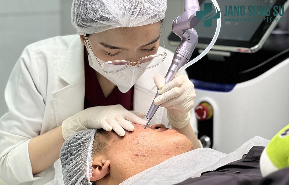 Hiệu quả cao với sẹo rỗ sâu Hiệu quả cao với sẹo rỗ sâu