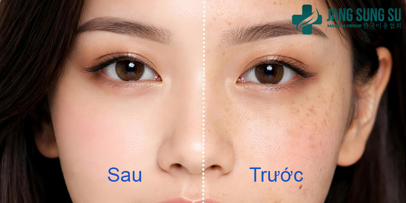 Quá trình thay đổi của chị Linh Quá trình thay đổi của chị Linh