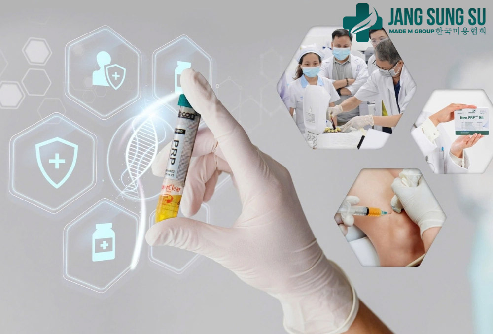 Một số lưu ý quan trọng trước và sau khi làm PRP Một số lưu ý quan trọng trước và sau khi làm PRP