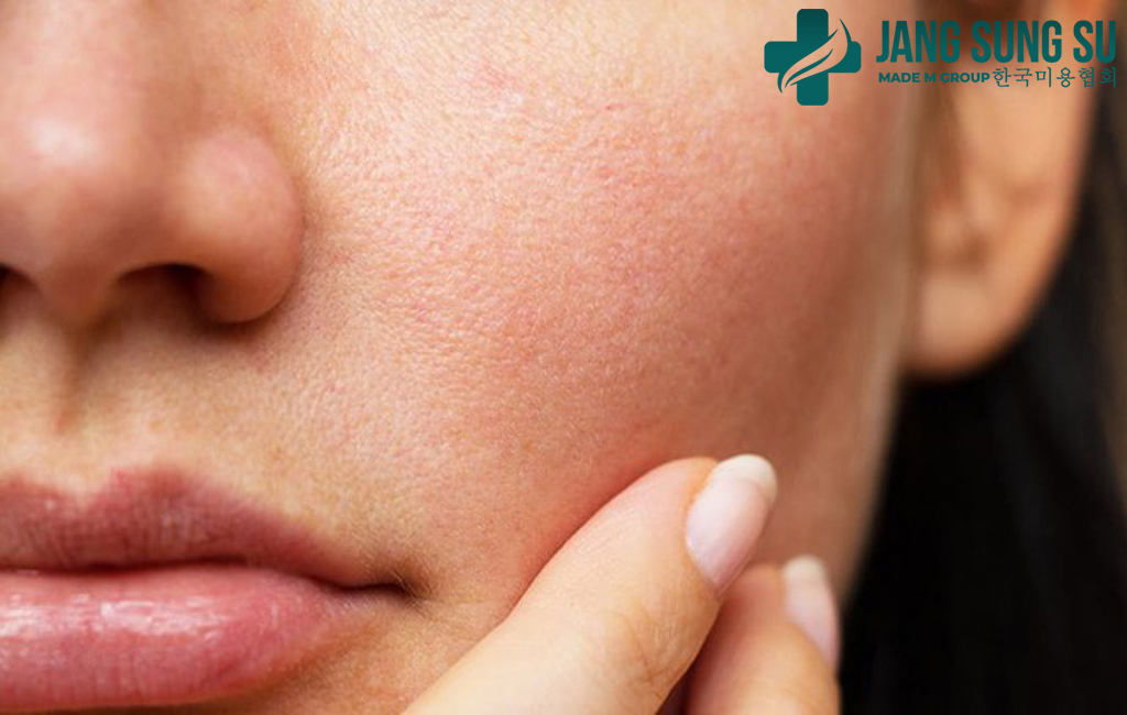 Lão hóa da sớm là gì? Lão hóa da sớm là gì?