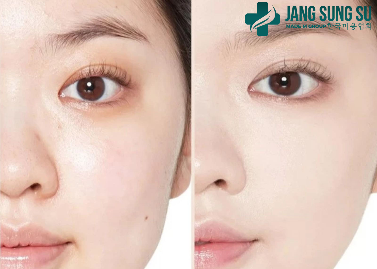 Ngăn ngừa và cải thiện tình trạng lão hóa da sớm như thế nào? Ngăn ngừa và cải thiện tình trạng lão hóa da sớm như thế nào?