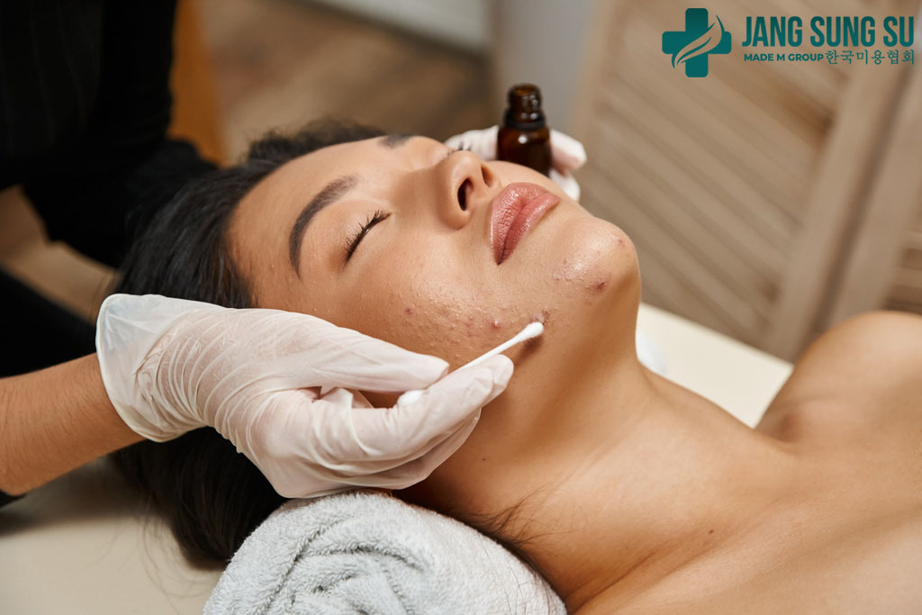 Những lưu ý khi điều trị mụn