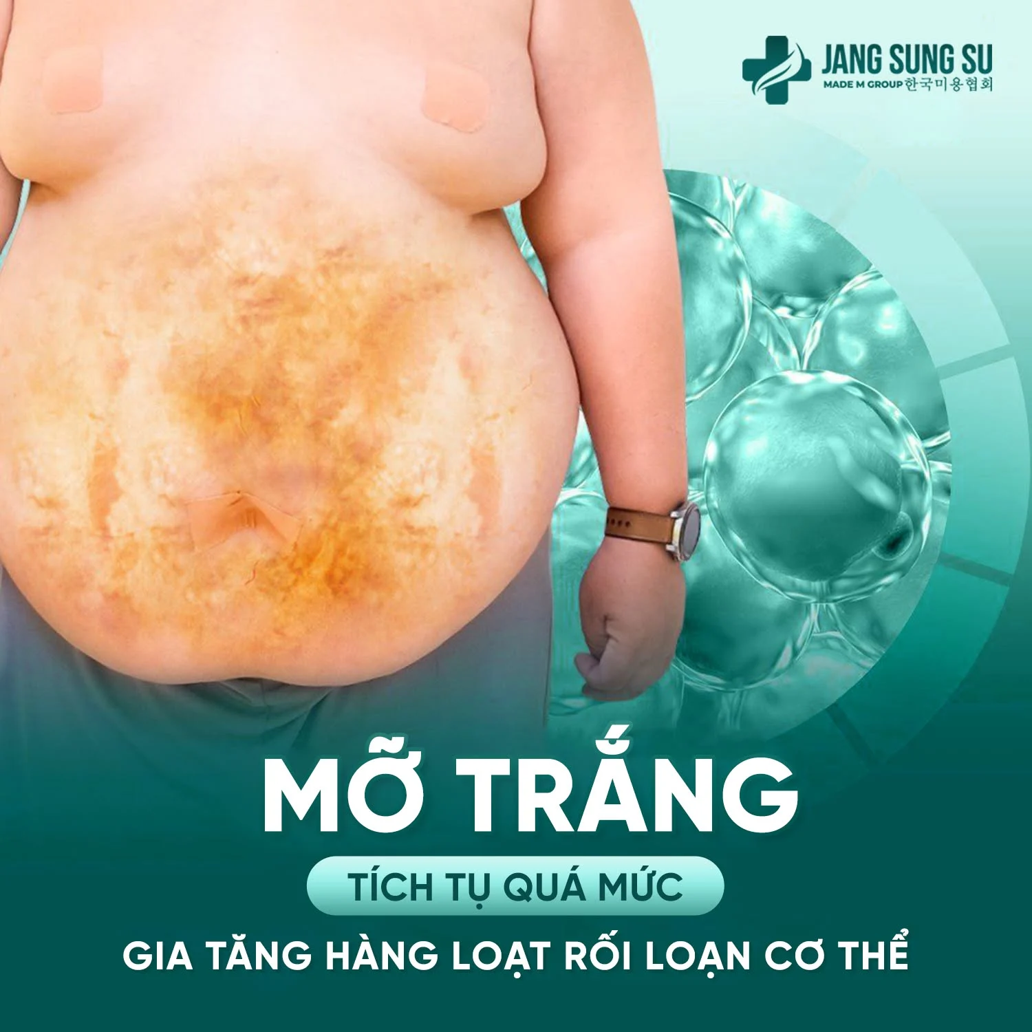 jang-sung-su-protocol-kiem-soat-can-nang-hieu-qua